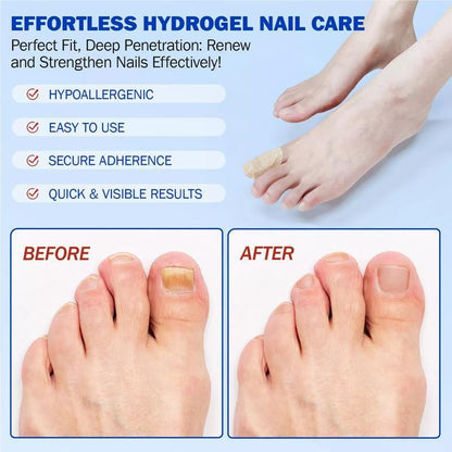 Fungal Nails? This Patch Solves It with Ease! ✅21pcs/box